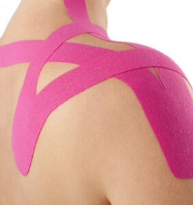 Kinesio tape kezelés